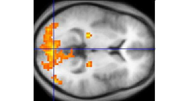 fMRI 計測によって得られた脳の画像。